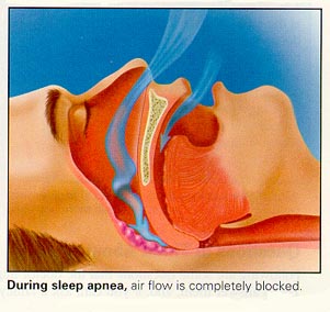 Ear Nose Throat Treatment India,Price Ent Surgery Delhi India