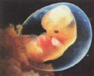 Embryo Donation Cost India, Embryo Adoption, Embryo Transfer IVF, IVF Cost, IVF India, Embryo Donation Bangalore India, Low Sperm Count, Male Infertility, Egg Donor, Fertility Clinic