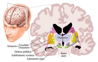 Thalamotomy Surgery India,Cost Thalamotomy Surgery Bangalore India, Cost Thalamotomy Surgery, Diseases And Conditions, Brain And Nerves, Thalamic Stimulation, Surgical Treatment Of Parkinson's Disease, Pallidal Stimulation, Thalamotomy Price