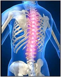 Cost of Spine Surgery in India