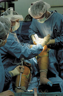 Both Knee Replacement Together Surgery India, Cost Knee Replacement Delhi