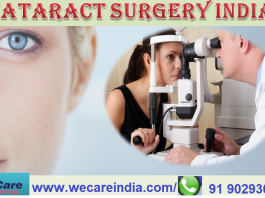 cataract surgery in India