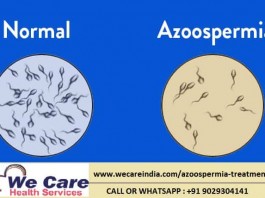 Azoospermia treatment in India