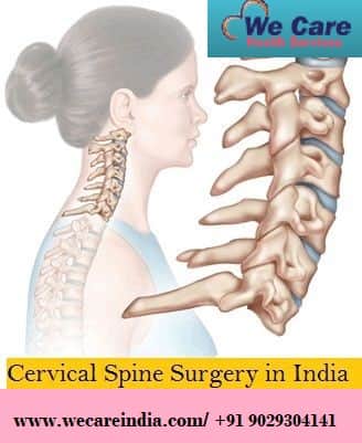 Cervical Spine Surgery India