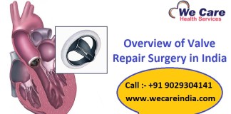 Valve Repair Surgery in India