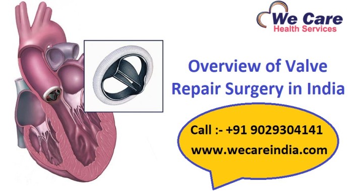 Valve Repair Surgery in India