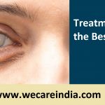 Cataract eye treatment in India