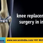 Which are the best hospitals for knee replacement surgery in India