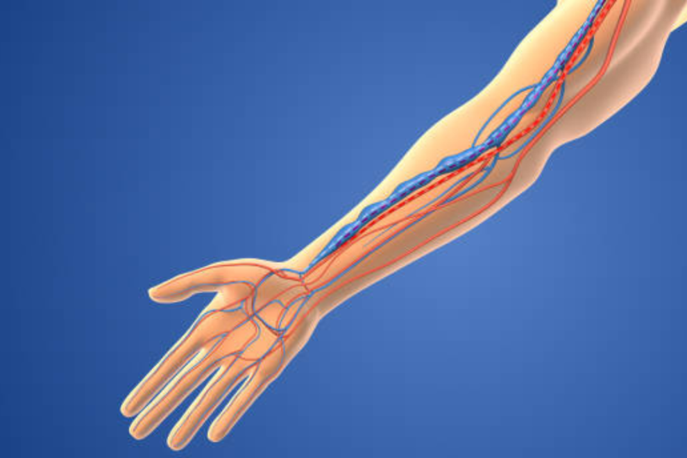 Arteriovenous Fistulas Surgery in India