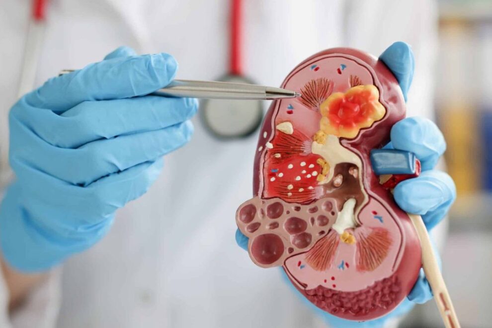 Renal Insufficiency Treatment in India: Advanced Kidney Care Solutions