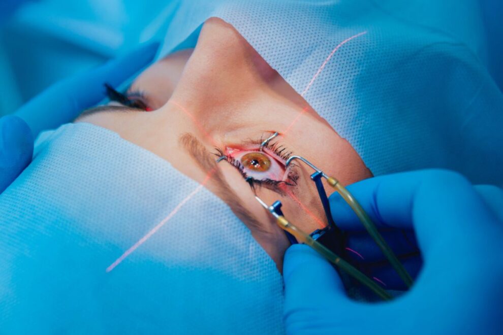 Spectacle Removal Surgery in India: Advanced LASIK & Vision Correction Options