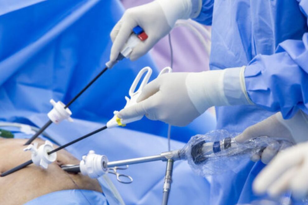 Laparoscopic Surgeries in India: Minimally Invasive Solutions for Optimal Health