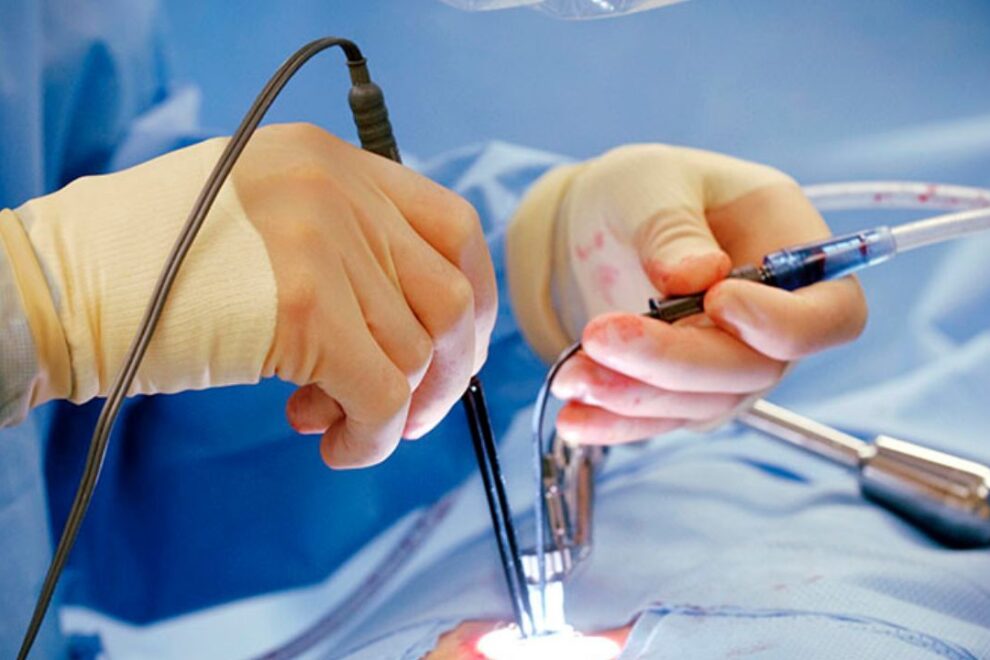 MVR Surgery in India