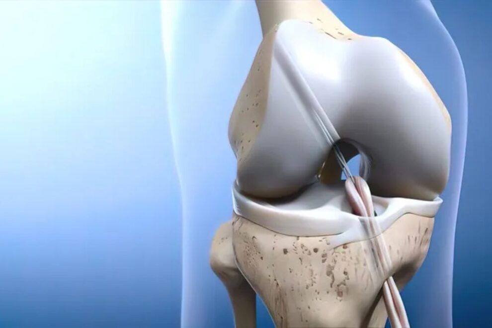 Partial Knee Replacement Surgery in India: Expert Care & Advanced Techniques