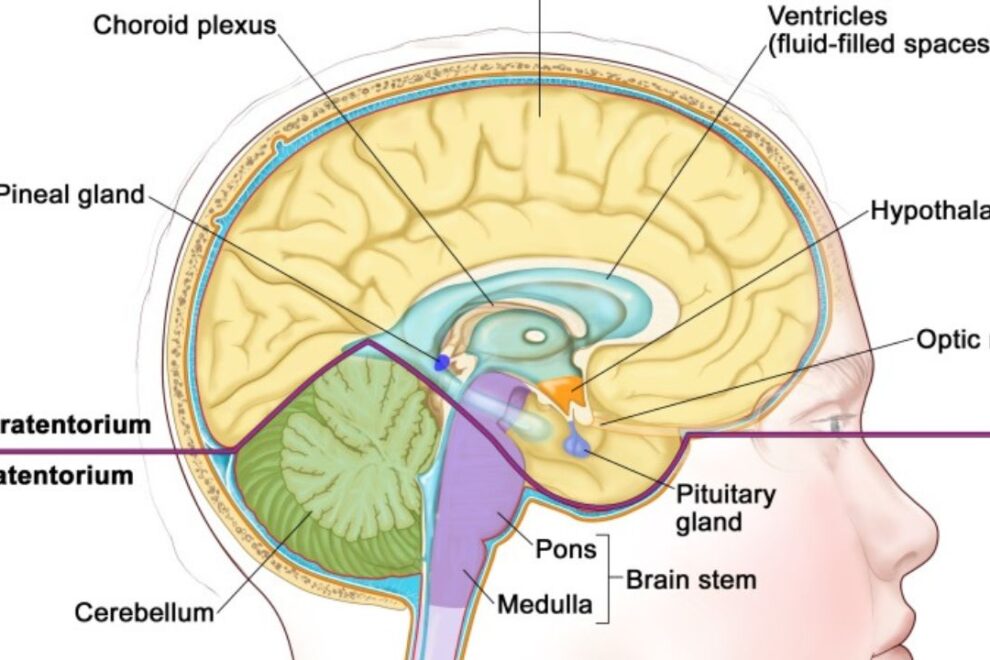 Pineal Region Tumors in India: Symptoms, Diagnosis, and Treatment Options