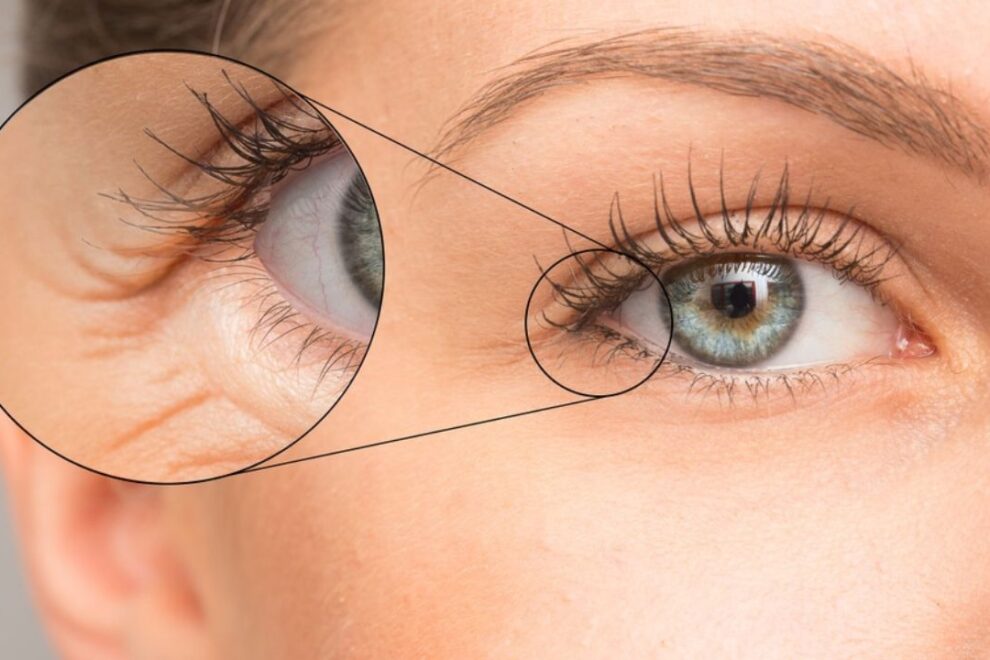 Expert Ptosis Correction Surgery in India | Restore Your Eye's Youthful Look