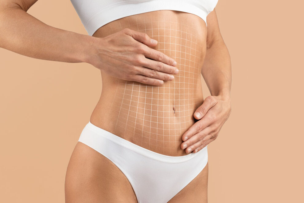 Abdominoplasty Tummy Tuck in India